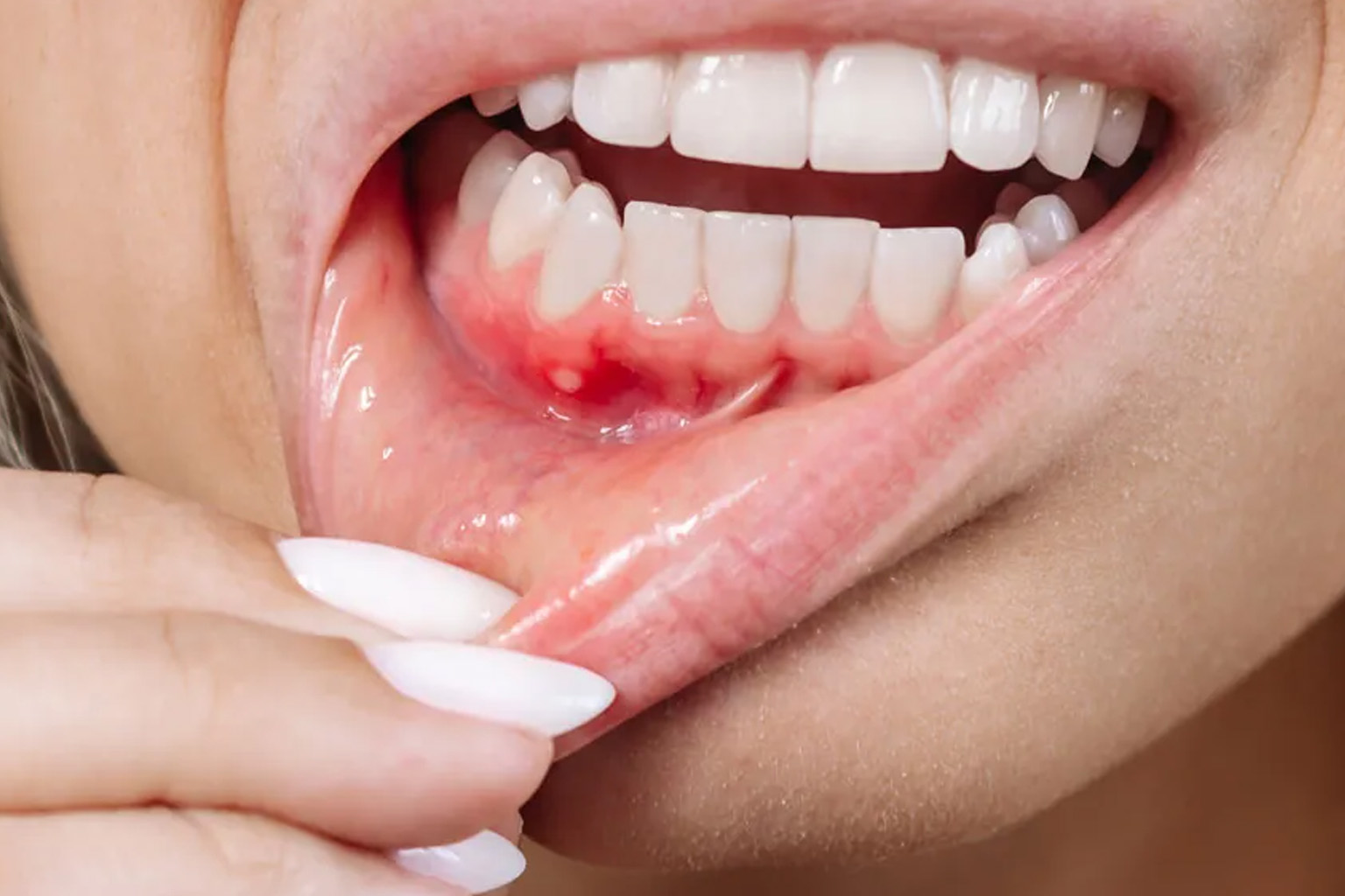 Symptoms of Tooth Infection