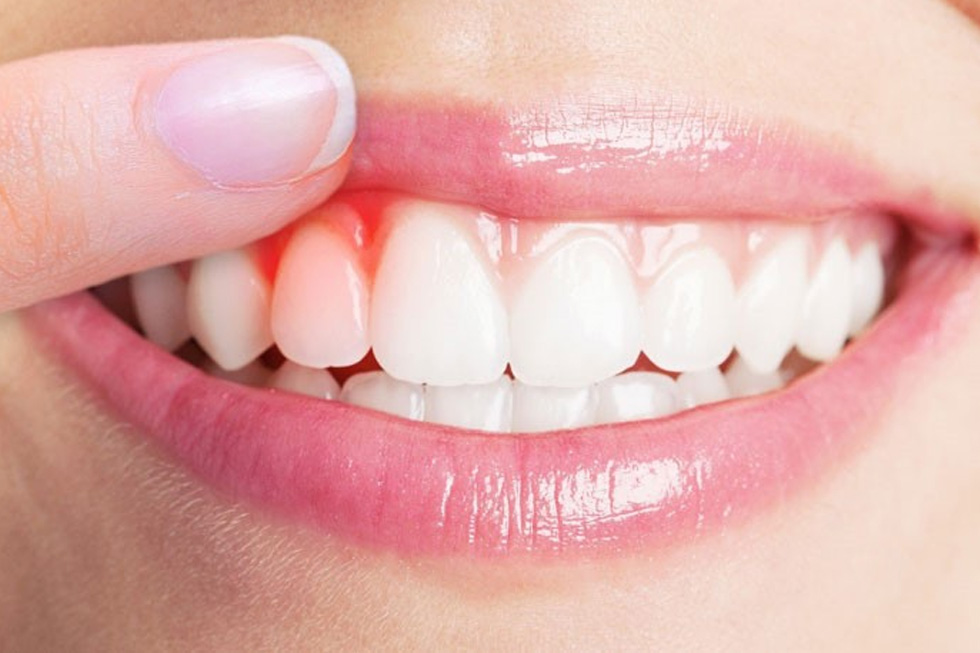 How Periodontal Treatment Really Saves Natural Teeth?