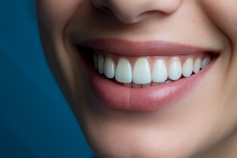 Why Do Some People Show More Gum Tissue When Smiling?